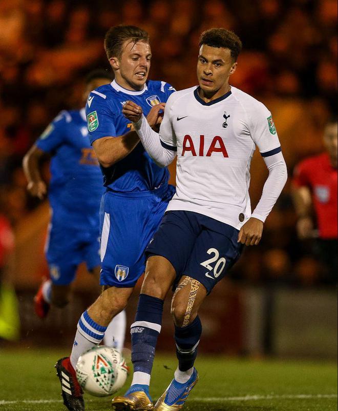 球内容的结 球内容的结